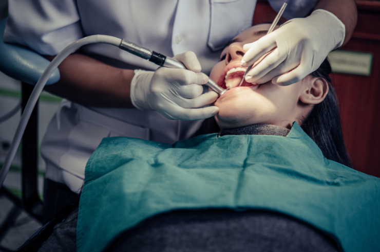 Wisdom Teeth Removal